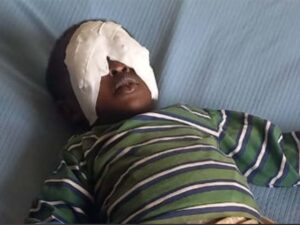 Kisii Boy Eyes Blinded [Photos] Bloody Gang Attack on a 3 Years Old Boy - Doctors & Detectives