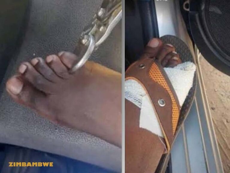 Zimbabwe Toes Cutting and Selling Business